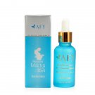 AFY Stretch Marks Removal Obesity Postpartum Repair Essential Oil Recovery 30ML