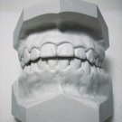 Mouth Guard Study Model