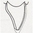 Non Prep Veneers