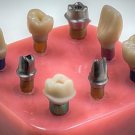 Fixed Restoration Customized Abutment