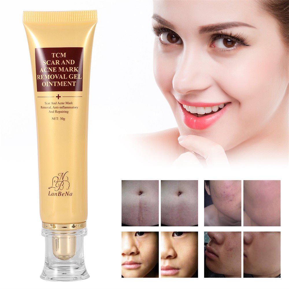 30g Acne Scar Removal Cream Skin Repair Face Cream Acne Spots Treatment