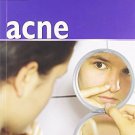 50 Things That Cause Acne [Aug 01, 2012] Hasanali, Inara