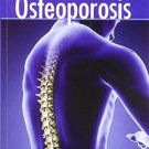 Defeat Osteoporosis [Paperback] [Sep 01, 2010] Dr Sushil Sharma