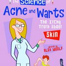 The Science of Acne & Warts: The Itchy Truth About Skin