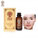 ZhiFangYuan Effective Eye Care Essential Oil Removal of Dark Circles
