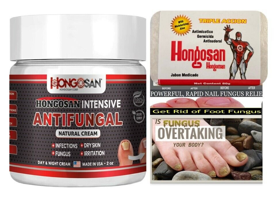 Jock Itch Cream EXTRA STRENGTH Antifungal Balm Relief Treatment