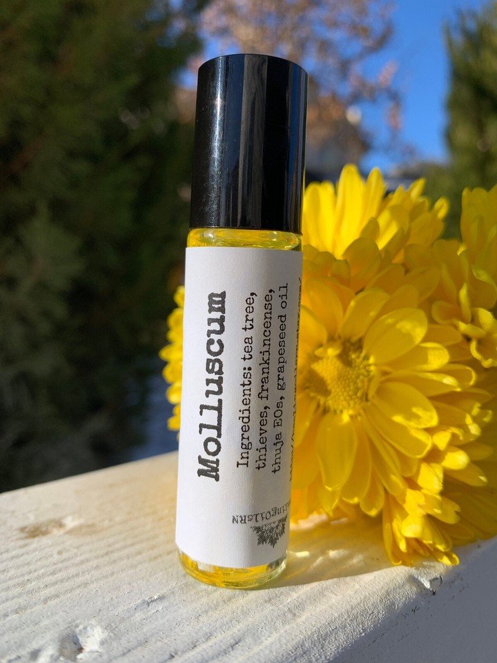 MOLLUSCUM Contagiosum OIL for adults