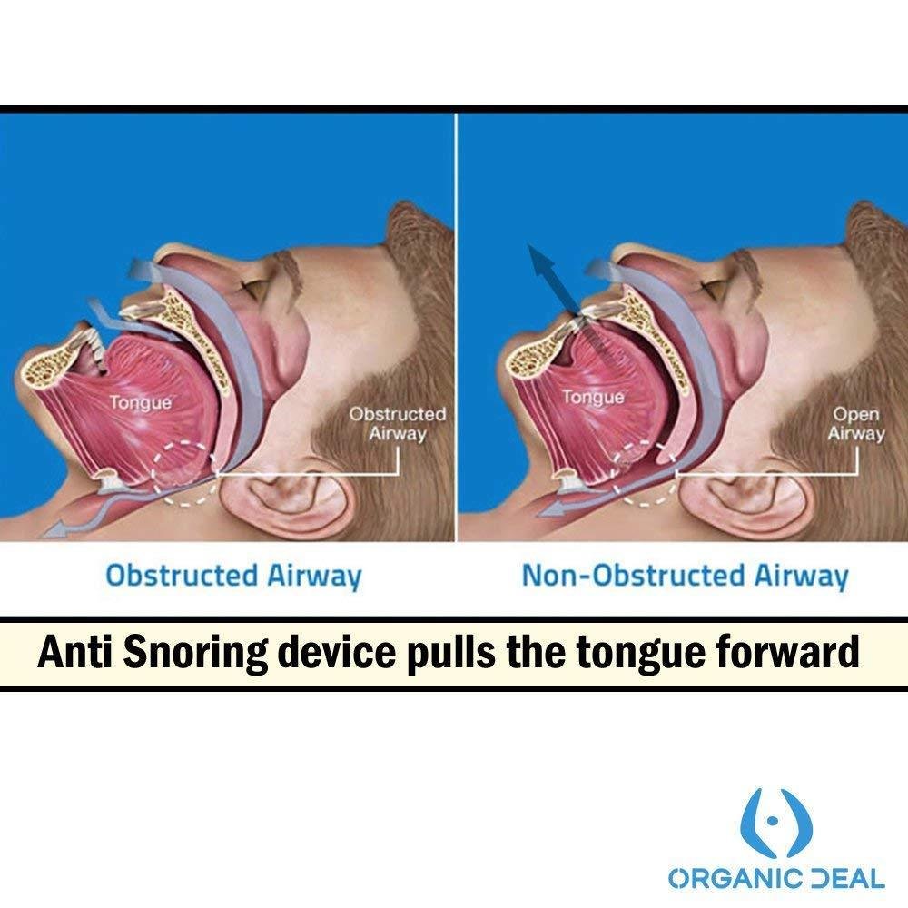 ANTI SNORING MOUTHPIECE TONGUE RETAINER HELPS TO REDUCE SNORING! Get a ...