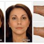 AWESOME SNAIL EXTRACT ANTI AGEING BLACKHEAD ACNE SCAR STRETCH MARK REPAIR CREAM