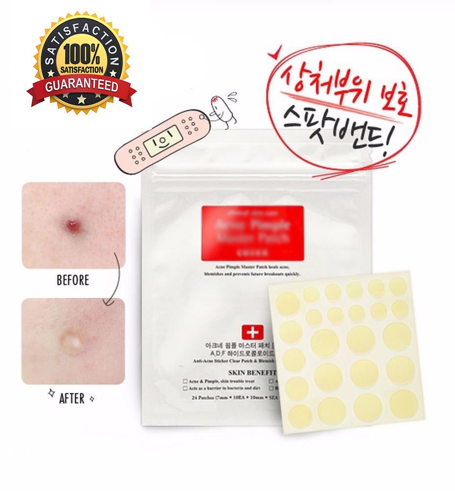 Face Care Acne Patches