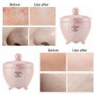 Hide Blemish on Your Face Skin