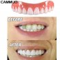 The Amazing Zippy Smile Gives You The Look Ff Perfect Teeth You'll Be Proud NEW