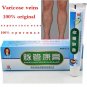 Effective treatment of varicose veins of lower limb pain and itching of the oint