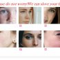 Strong effects Powerful whitening Freckle cream 20g Remove melasma Acne Spots