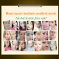 Strong effects Powerful whitening Freckle cream 20g Remove melasma Acne Spots