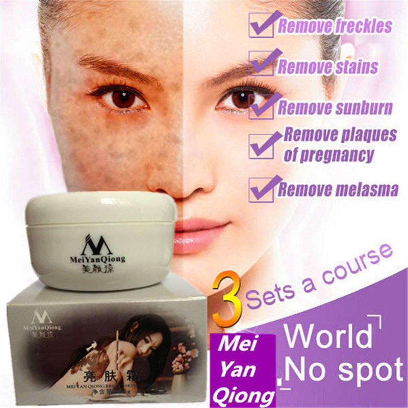 Whitening Freckle Cream 40g Remove Melasma Acne Spots Pigment Melanin Face Care