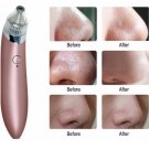 Skin Care Beauty To Blackheads Electric Artifacts Acne Home Pores Clean Exfoliat