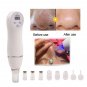 Diamond Facial Pore Cleanser - Perfect Pore Cleanser - Blackhead Vacuum Remover