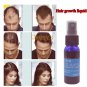 Hair Growth Pilatory Stop Loss Fast Products Yuda Restoration Men And Woman New