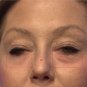 comprar ageless - super desconto - como comprar o creme instantly ageless