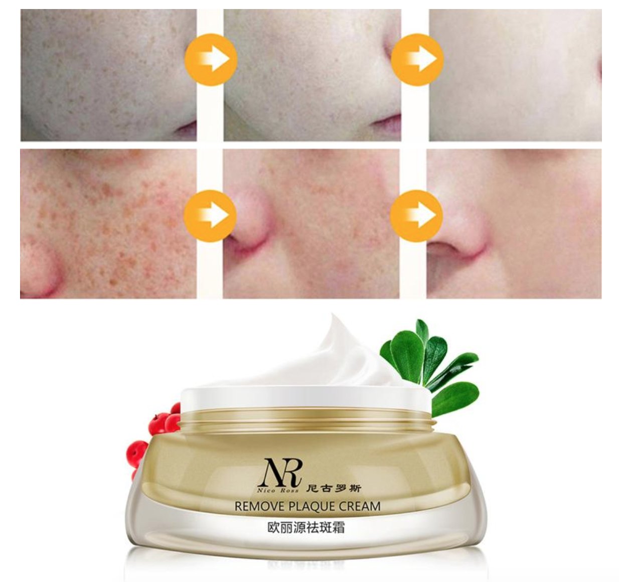 Freckle Remove Plaque Cream Whitening Repair Fade Spot Facial Eliminate Melanin!
