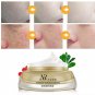 Freckle Remove Plaque Cream Whitening Repair Fade Spot Facial Eliminate Melanin!