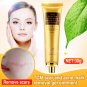 30g Scar Acne Mark Removal Gel Face Pore Skin Repair Stretch Marks Cream Blemish