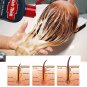Dexe 200ml Anti Lossing Hair Shampoo Chinese Herbal Hair Care & Regrowth Unisex