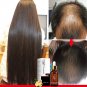 Hair Growth Essence 30ml for Hair Growth Ointment Hair Growth Fluid Unisex US