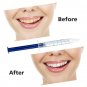 Advanced Teeth Whitening Kit Tooth Whitener Gel Bleach White Dental Laser System