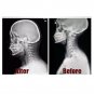 Air Inflatable Pillow Cervical Neck Head Pain Traction Support Brace Device New