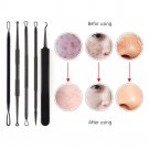5Pcs Blackhead Acne Comedone Pimple Blemish Extractor Remover Tool Kit Set Black