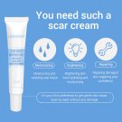 Face Skin Care Acne Removal Cream Scar Blemish Marks Authentic For Man&Women New