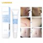Face Skin Care Acne Removal Cream Scar Blemish Marks Authentic For Man&Women New