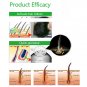 Anti Hair Loss 200ml Dexe Shampoo Chinese Herbal Induce Regeneration Growth
