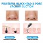 Portable Face Pore Cleanser Vacuum Suction Blackhead Extractor Acne Remover Tool