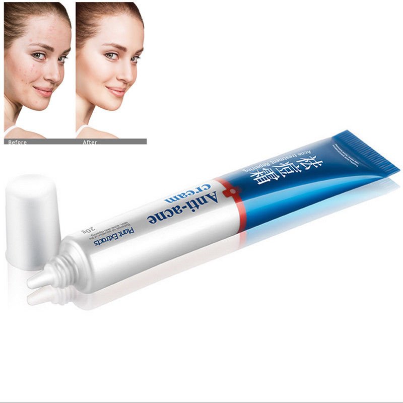 20g Face Skin Care Acne Removal Cream Spots Scar Blemish Marks Authentic Useful