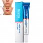 20g Face Skin Care Acne Removal Cream Spots Scar Blemish Marks Authentic Useful
