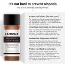 LANBENA Anti Hair Loss Essence Fast Sunburst Dense Hair Growth Product 0.7fl.OZ