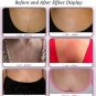 Anti Wrinkle Chest Pad Prevent Eliminate Wrinkles 100% Silicone Skin Beauty Care