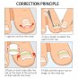 Toe Nail Ingrown Correction Sticker Patch Foot Care Paronychia Corrector 10pcs