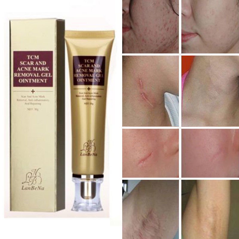 Scar Remover Serum Acne Scars And Stretch Marks Hot Deal