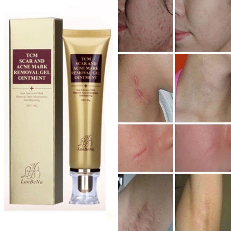 Scar Remover Serum - Acne Scars & Stretch Marks Hot Deal