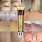 Scar Remover Serum - Acne Scars & Stretch Marks Hot Deal