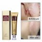 Scar Remover Serum - Acne Scars & Stretch Marks Hot Deal