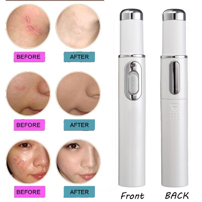 Medical Blue Light Therapy Laser Treatment Pen Original (