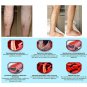 Varicose Veins Treatment Cream