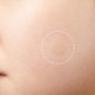 DERMOPATCH - 24H ACNE REMOVER SET (24 PCS) - TOP PRODUCT - FREE SHIPPING