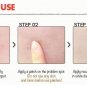 DERMOPATCH - 24H ACNE REMOVER SET (24 PCS) - TOP PRODUCT - FREE SHIPPING