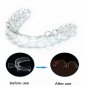 Anti-Cheek Biting Dental Guard Mouth Teeth Grinding Aid Clenching Mouthguard